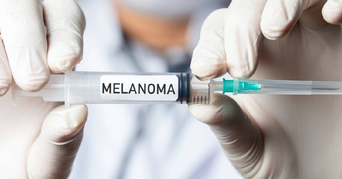 Merck y Moderna informaron el 19 de agosto del 2026 los resultados positivos en fase 3 de los ensayos clínicos contra el cáncer de piel.